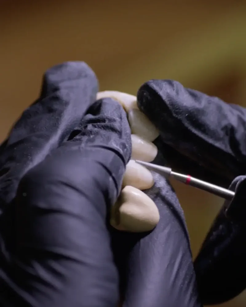 One Life technicians handcraft dental crowns in Turkey