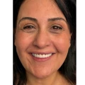 Kavin-Shohag-Turkey-Dental-Implants-Reviewer