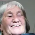 Sarah-UK-after-dental-implants-Turkey