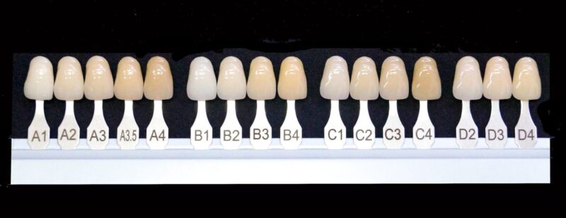 Pictures displaying the full color palette of the VITA teeth shade guide