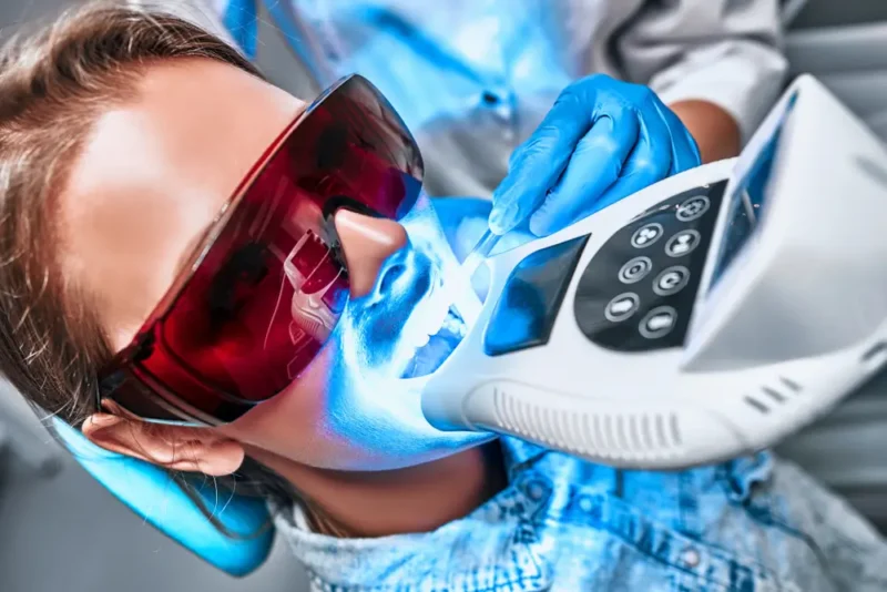 Close-up of a patient receiving UV-lighting on her teeth bonding during teeth whitening