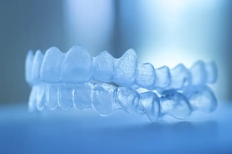 Upper and lower Invisalign clear aligner trays, a discreet alternative to traditional braces.