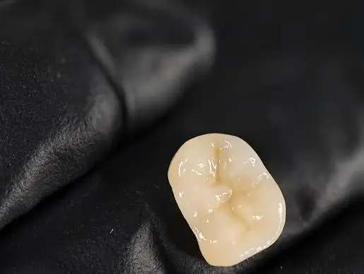 A close-up view of an All Porcelain Dental Crown resting on a black-gloved hand.