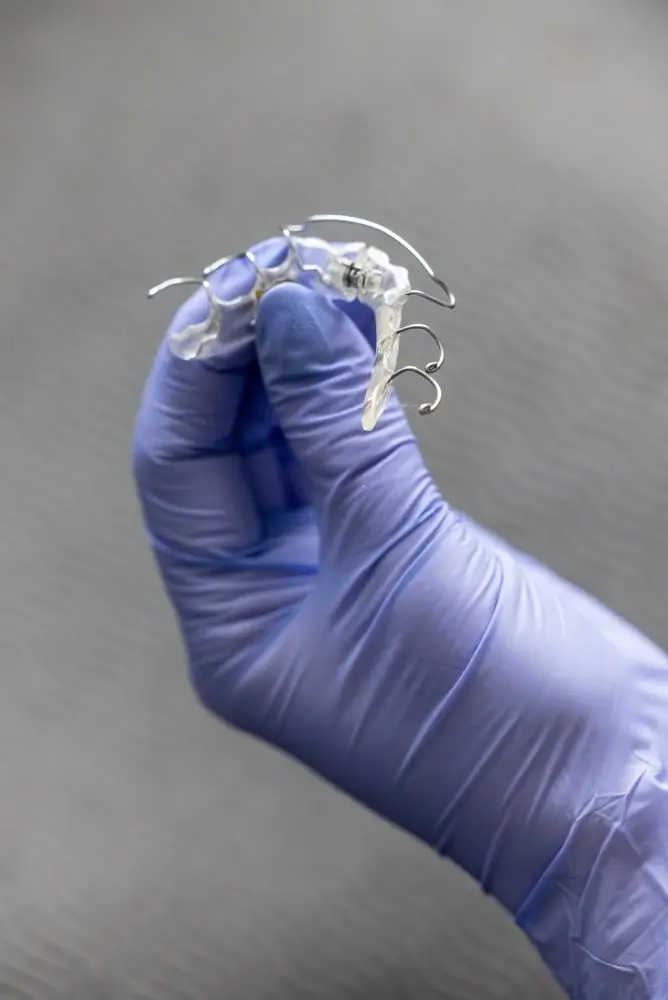 Close-up shot of a hand wearing a blue nitrile glove holding a transparent orthodontic retainer with intricate metal wires.