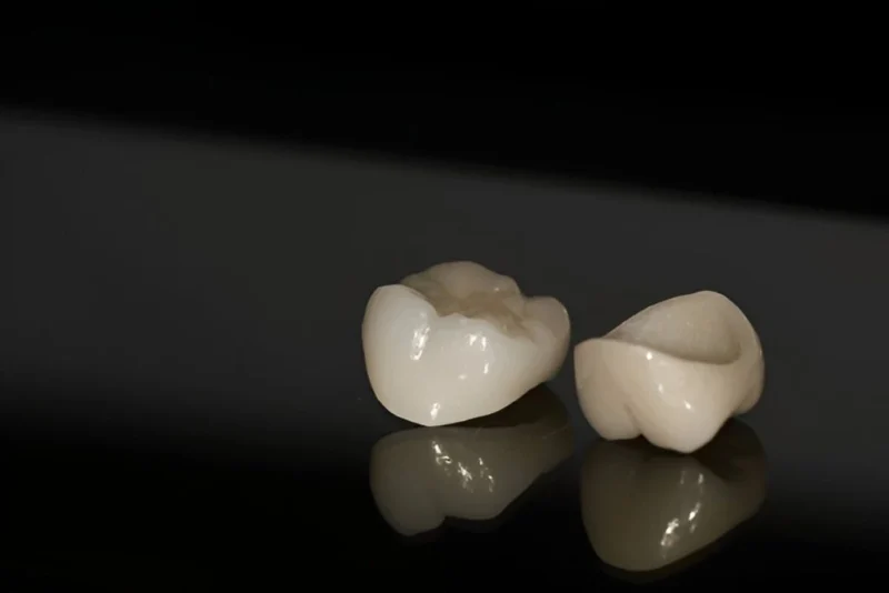 Two tooth-colored Composite Resin Dental Crowns resting on a dark, reflective surface, with one showing the biting surface and the other showing the hollow interior.
