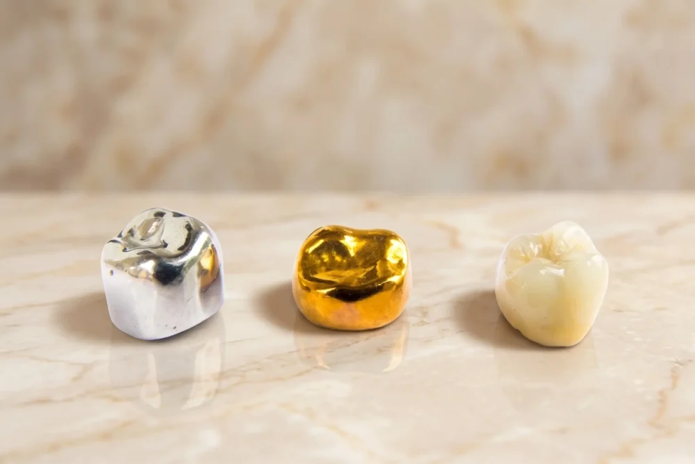 A silver, gold, and porcelain tooth side-by-side on a marble surface, illustrating the different types of dental crowns and cost options.