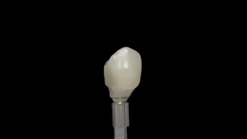 A close-up view of a Zirconia Ceramic Dental Crown mounted on a metal post against a solid black background.